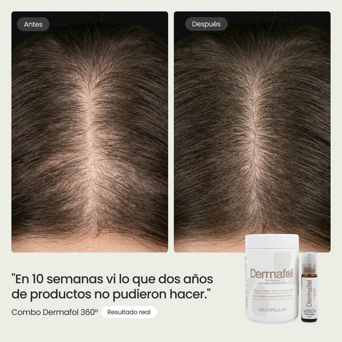 Antes y después de una clienta tras diez semanas de tratamiento.